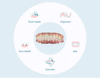 The five areas of the Align Oral Health Suite: tooth health, alignment, bite, overview, and gum health