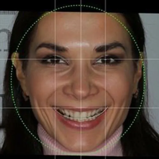 digital_smile_design