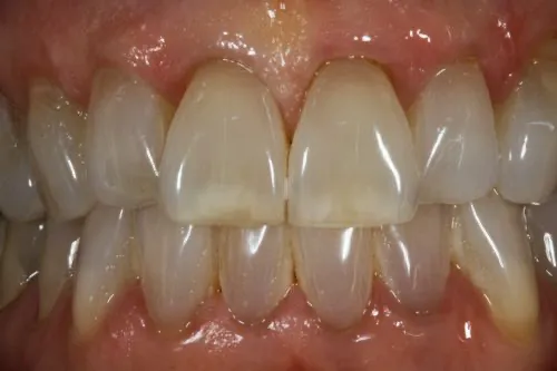 original_tetracycline_staining