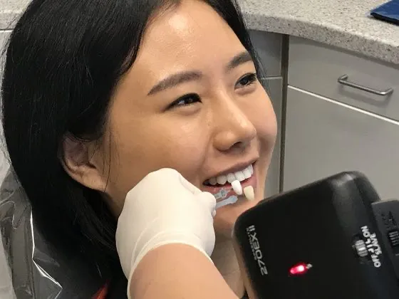 teeth-whitening-after