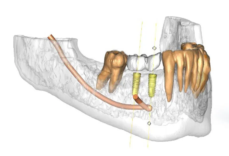 unique-jaw-structure