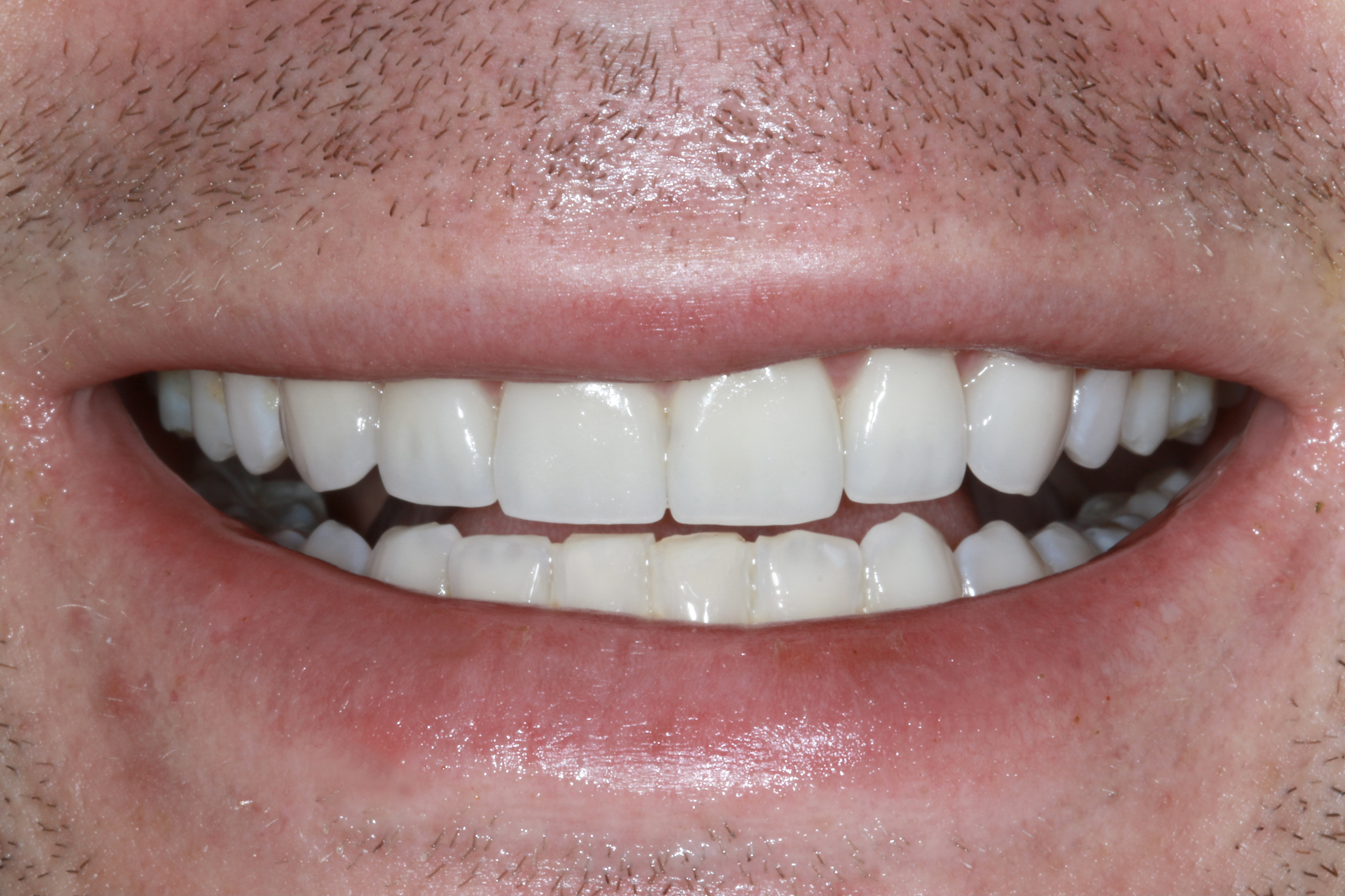 2CF48A00-1D28-4DEF-84C8-7AAD09CF9E87