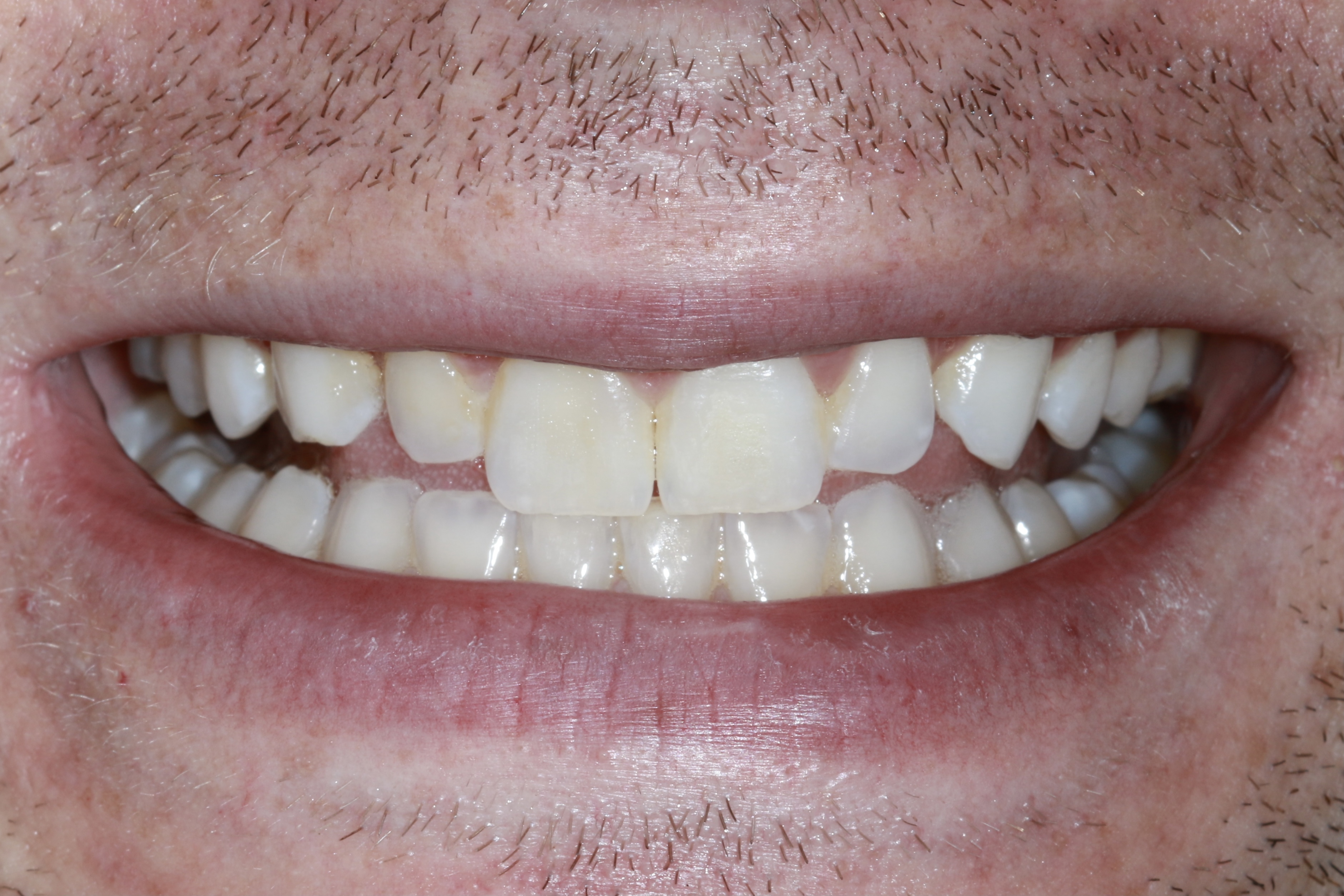 ECFE9F4E-2801-4166-96C5-68BC39D58EED