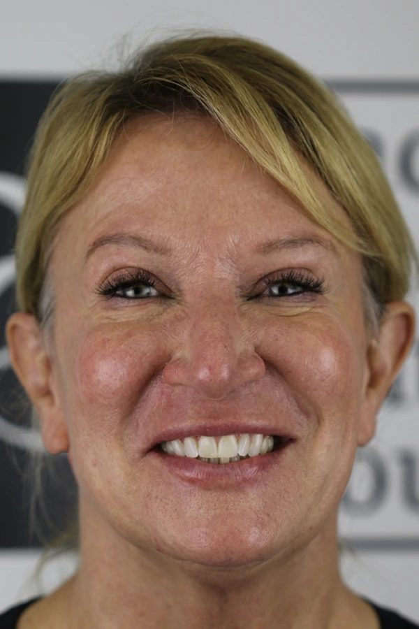 case-kim-before-full