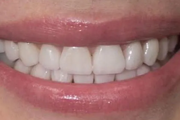 change-the-translucency-after