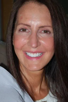 changing-shape-after-full-face