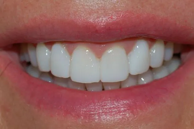 changing-shape-after