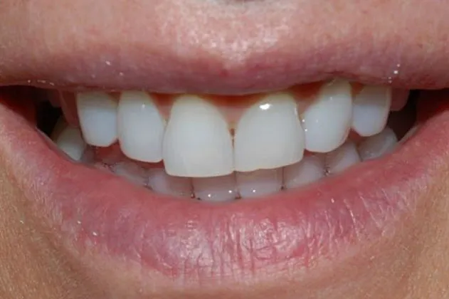 changing-shape-before