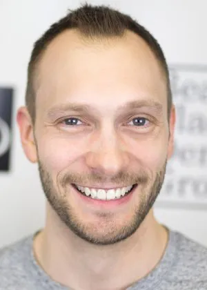 no-more-braces-after-full-face