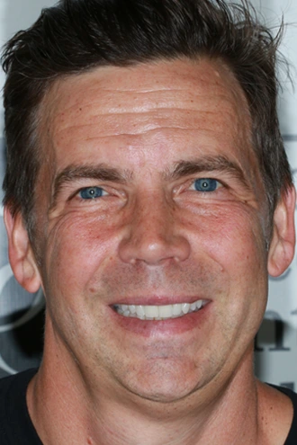 porcelain-veneers-case-05-after-f