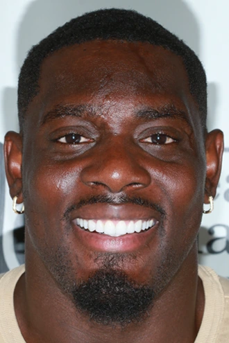 porcelain-veneers-case-05-after-f