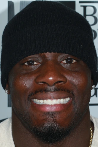 porcelain-veneers-case-05-before-f