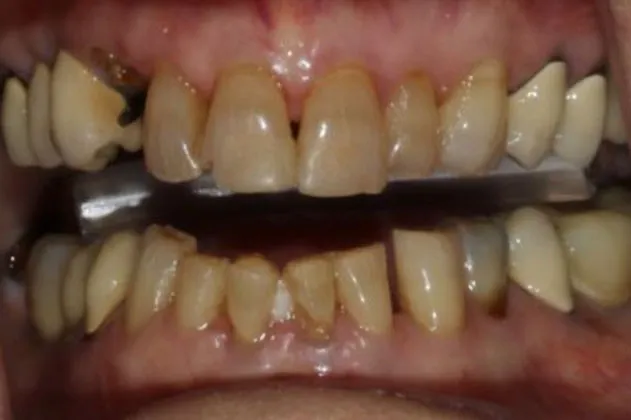 smile-makeover-case-02-before