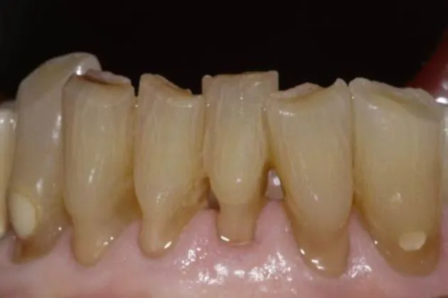 smile-makeover-case-03-before