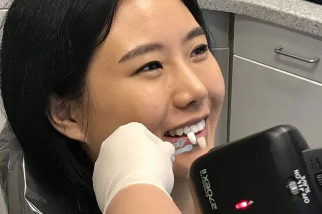 teeth-whitening-after-case-07-comparison